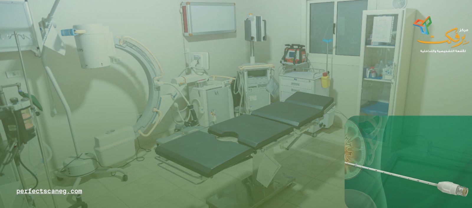 أخذ العينات وإجراء بزل للتجمعات – Perfect Scan